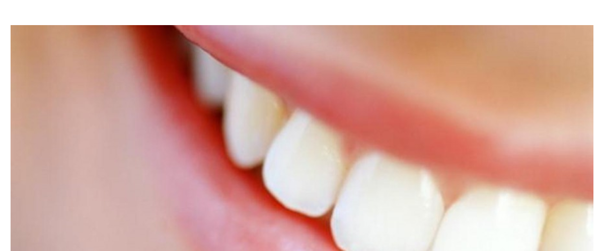 Sorriso Escova Dental